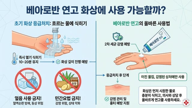 베아로반 연고 화상에 사용 가능할까?