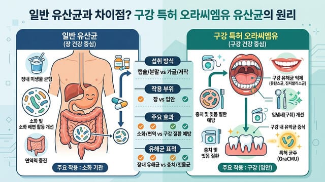 일반 유산균과 차이점? 구강 특허 오라씨엠유 유산균의 원리